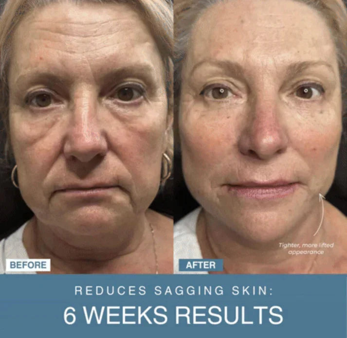 𝙎𝙚𝙝𝙖 𝙇𝙪𝙭𝙚™ 7-in-1 LED Anti-Aging/Wrinkle Apparatus