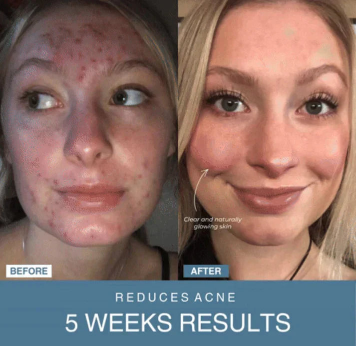 𝙎𝙚𝙝𝙖 𝙇𝙪𝙭𝙚™ 7-in-1 LED Anti-Aging/Wrinkle Apparatus