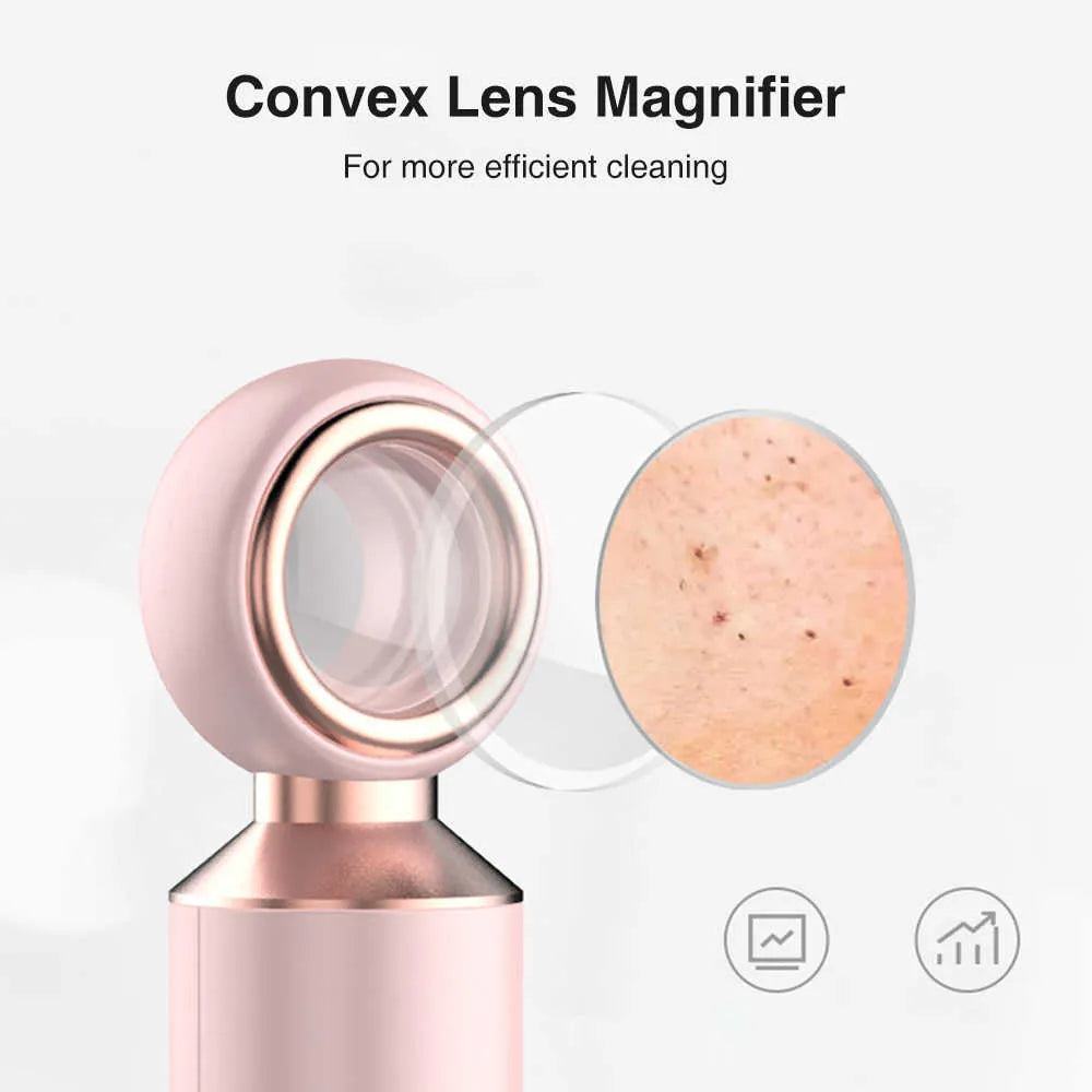 𝙎𝙚𝙝𝙖 𝙇𝙪𝙭𝙚™ Blackhead Suction Machine